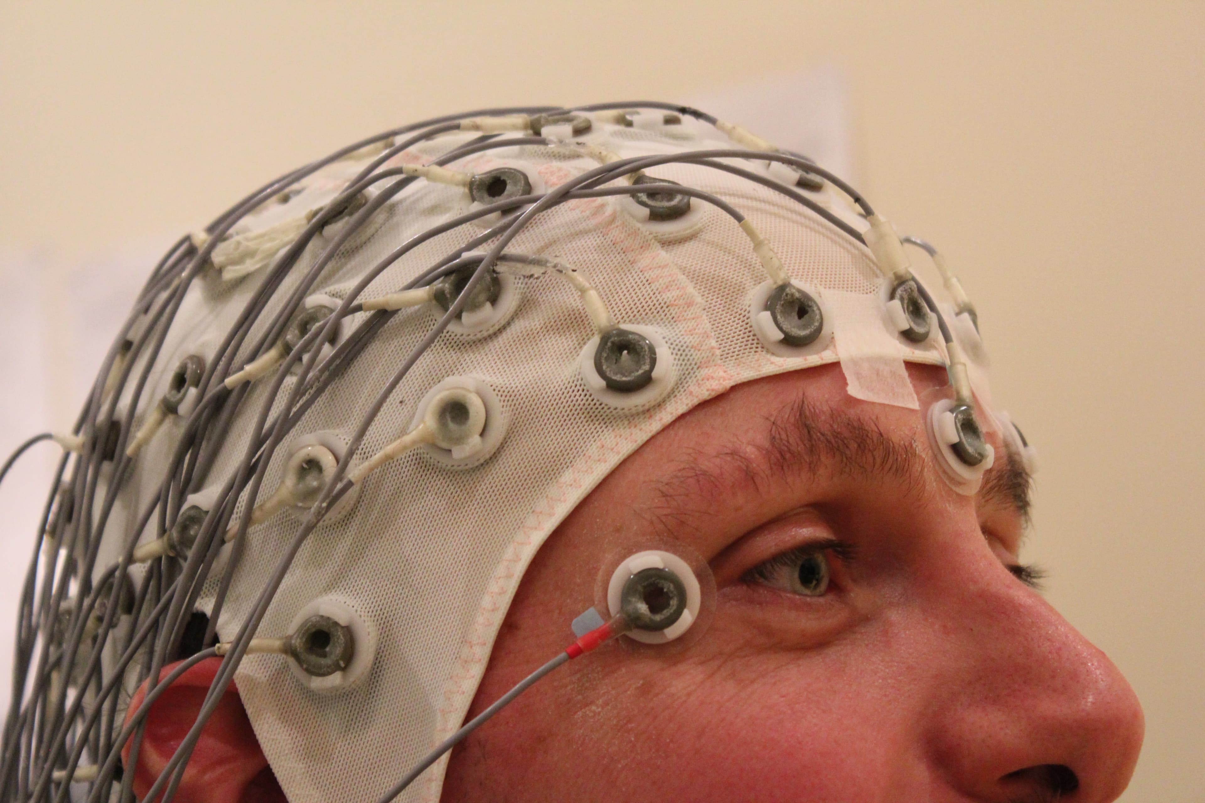 EEG recording cap with scalp electrodes used for complementary observation of brain activity.